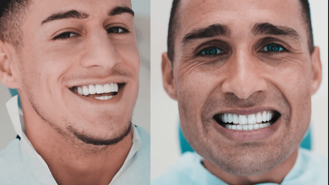 Hvordan Smilet Vårt Kan Påvirke Oss Og Andre